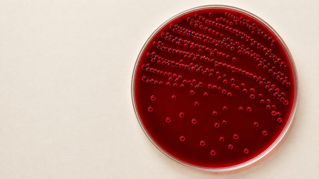 A blood-agar culture plate photographed from directly above: a round petri dish of deep red medium, its lid off, with small pale cream-coloured bacterial colonies growing in a scatter of dots and short streak lines across the surface.